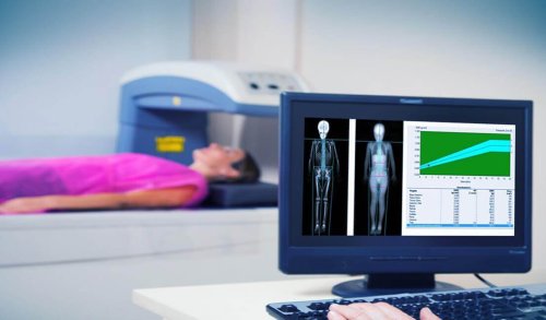 Densitometria Óssea